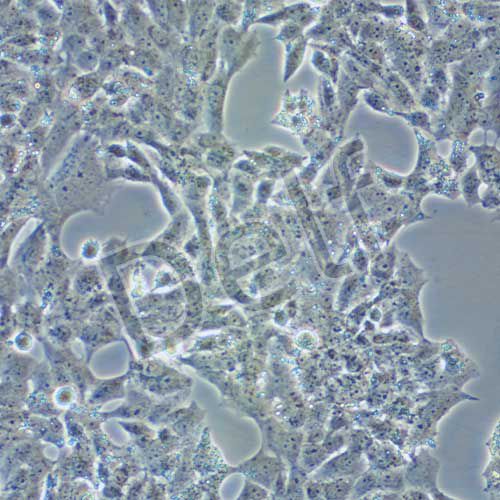 NCI-H295R 人腎上腺皮質(zhì)腺癌細胞