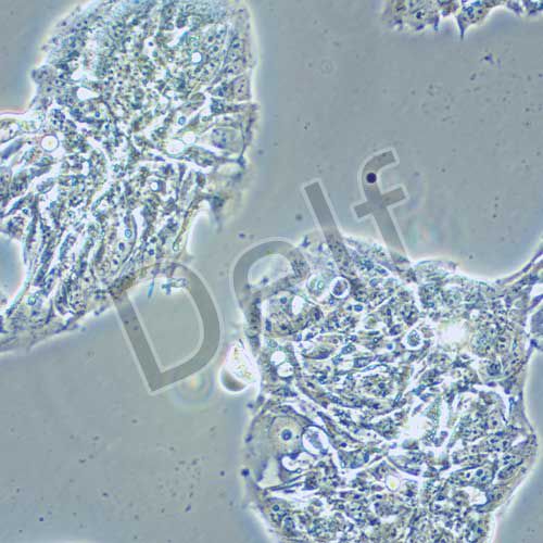 NCI-H358 人非小細(xì)胞肺癌細(xì)胞