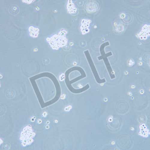 NCI-H524 人非小細胞肺癌細胞