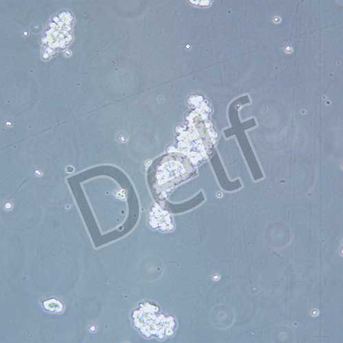 NCI-H524 人非小細胞肺癌細胞