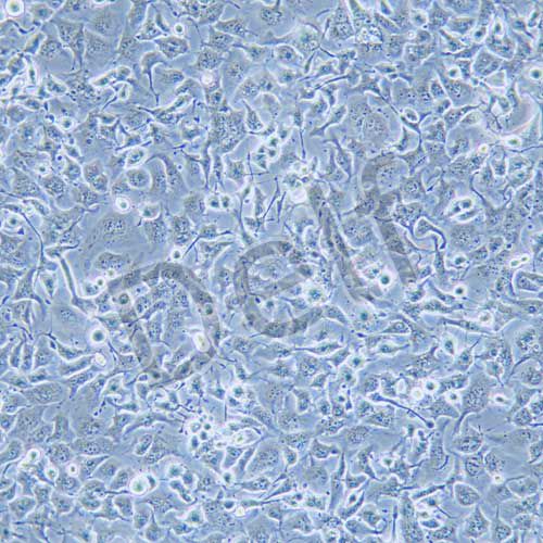 NCI-H661 人大細胞肺癌細胞