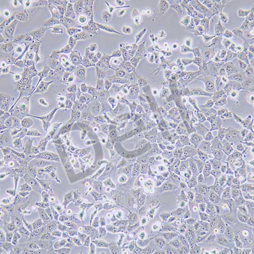 NCI-H1299 人非小細(xì)胞肺癌細(xì)胞