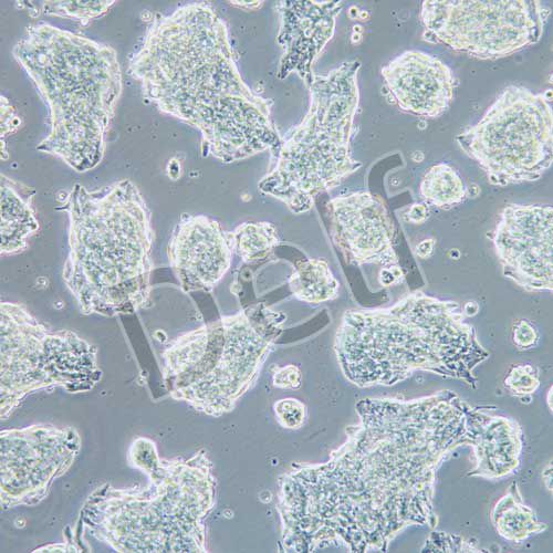 NCI-H1688 人經(jīng)典小細(xì)胞肺癌細(xì)胞