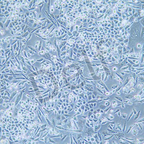 NCI-H1703 人肺鱗癌細(xì)胞