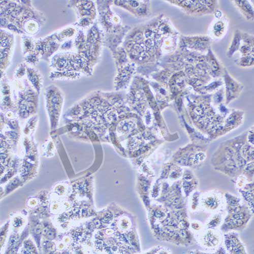 NCI-H1944 人肺癌細胞