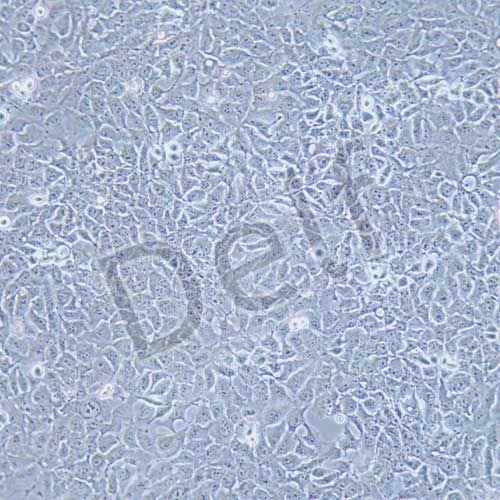NCI-H1975 人肺腺癌細胞