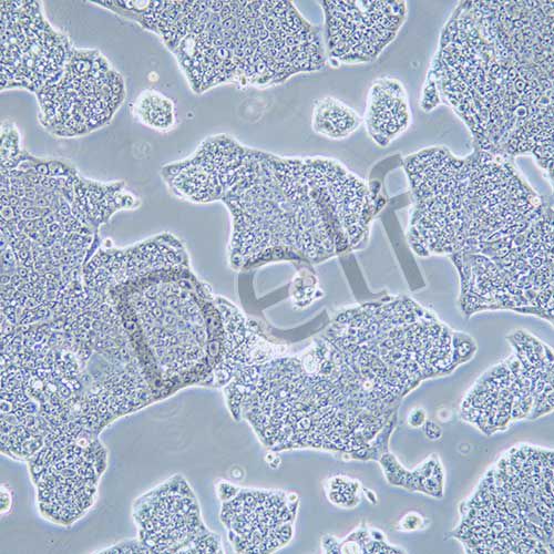 NCI-N87 人胃癌細胞