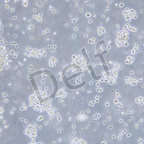 NK92 人惡性非霍奇金淋巴瘤患者的自然殺傷細(xì)胞