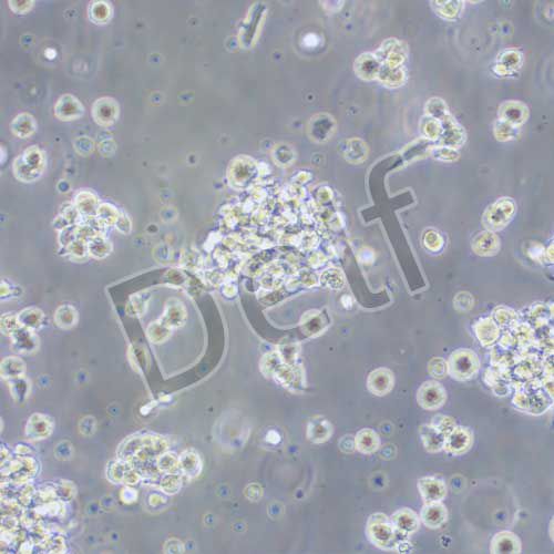 NK92 人惡性非霍奇金淋巴瘤患者的自然殺傷細(xì)胞