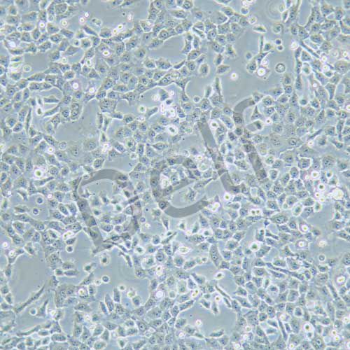 NPC/HK-1 人鼻咽癌細胞