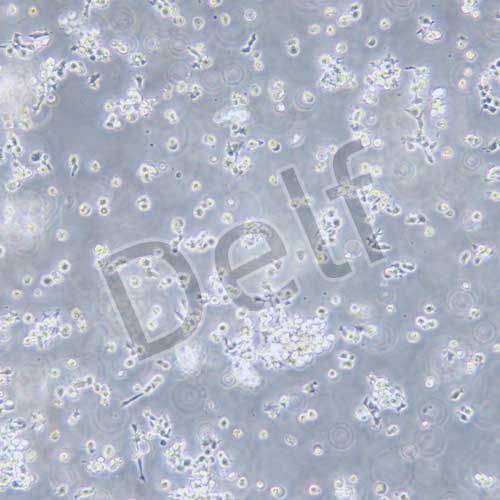 OCI-LY3人彌漫大B細(xì)胞淋巴瘤細(xì)胞