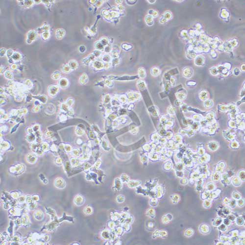 OCI-LY3人彌漫大B細(xì)胞淋巴瘤細(xì)胞