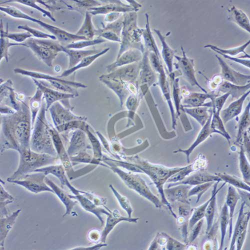 OCM1A 人眼脈絡黑色素瘤細胞