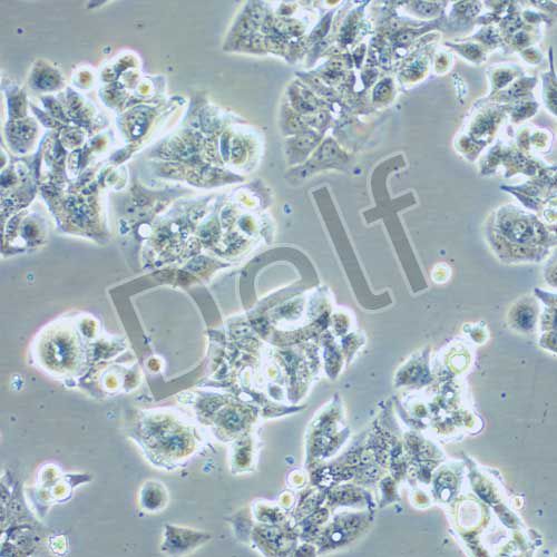 OE-19人食管癌細(xì)胞