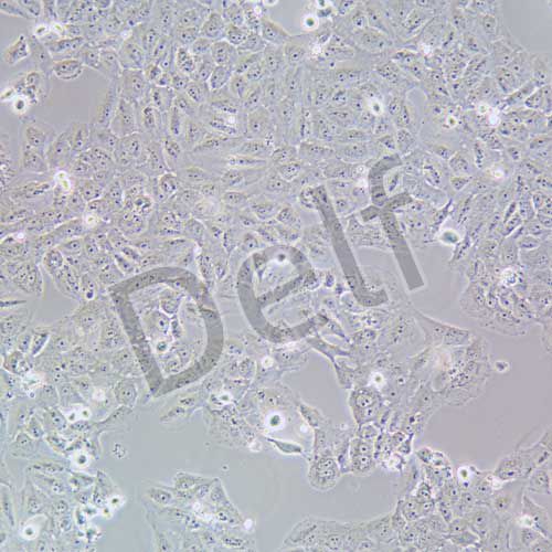 OVCAR-8 人卵巢癌腺癌細(xì)胞