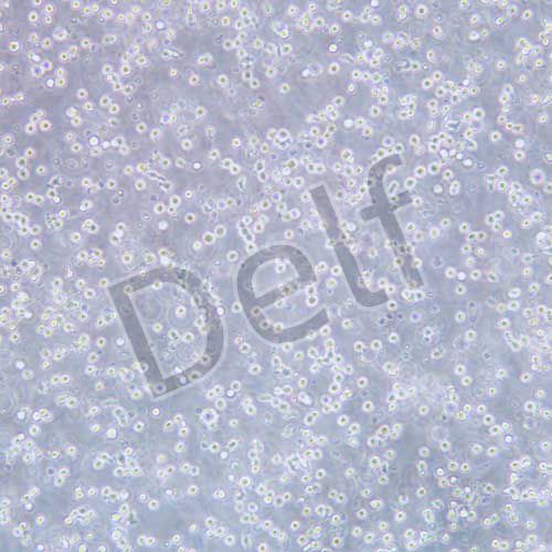 P815 小鼠肥大細(xì)胞瘤細(xì)胞