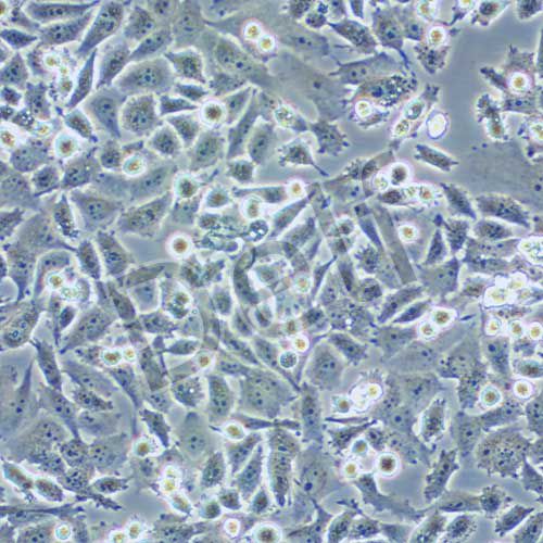 PATU 8988t 人胰腺癌細(xì)胞