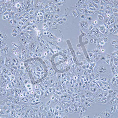 PL45 人胰腺導(dǎo)管腺癌細(xì)胞