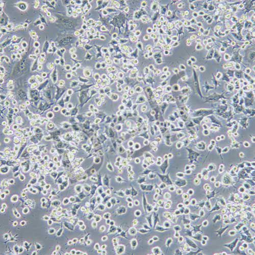 RAG 小鼠腎腺癌細胞