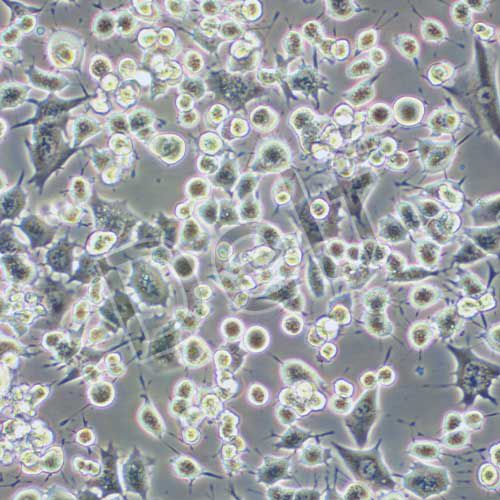 RAG 小鼠腎腺癌細胞