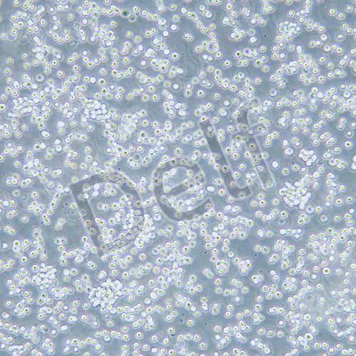 Raji 人淋巴瘤細胞