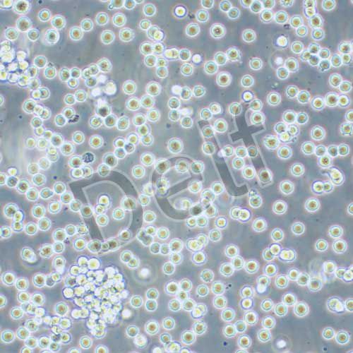 Raji 人淋巴瘤細胞