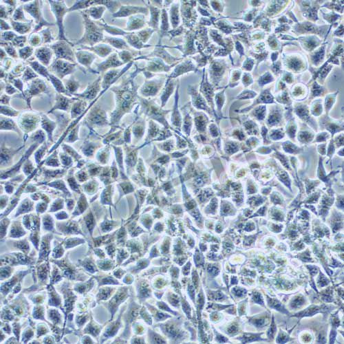 RD 人橫紋肌肉瘤細胞