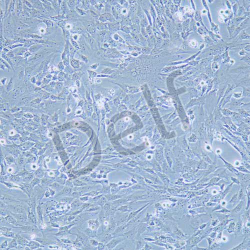 RGC-5 小鼠視網(wǎng)膜神經(jīng)節(jié)細(xì)胞