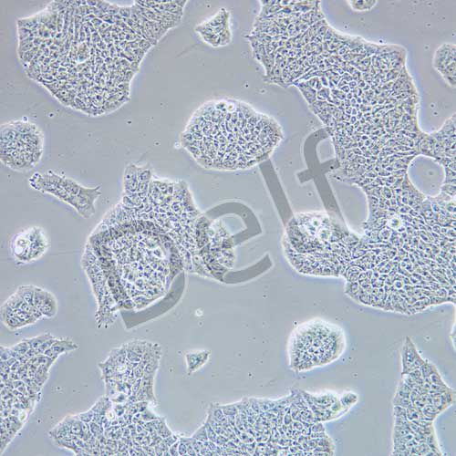 RT4 人膀胱移行細(xì)胞乳頭瘤