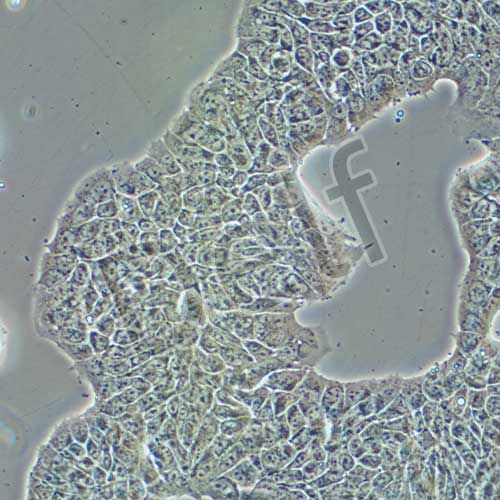 RT4 人膀胱移行細(xì)胞乳頭瘤