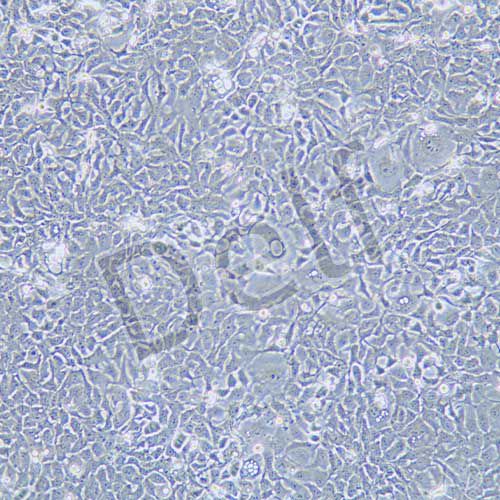 RT112 人膀胱癌細(xì)胞