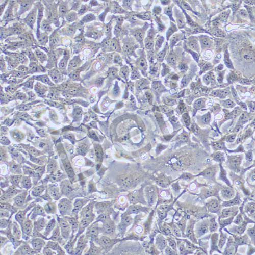 RT112 人膀胱癌細(xì)胞