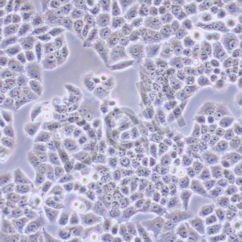 SBC-2 人小細(xì)胞肺癌細(xì)胞