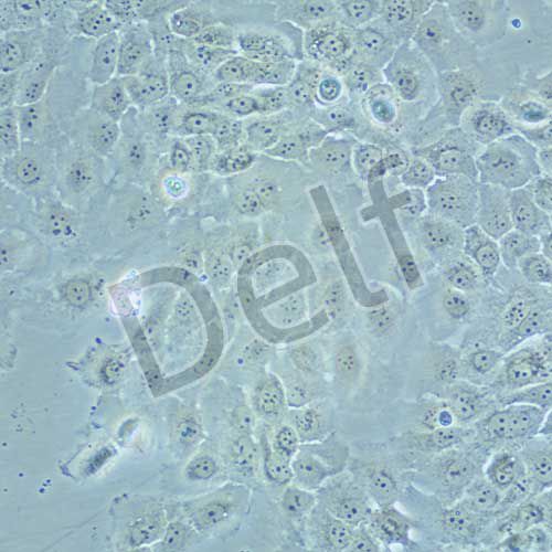 SCaBER 人膀胱鱗癌細胞