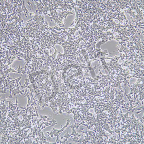 SH-SY5Y 人神經(jīng)母細(xì)胞瘤細(xì)胞