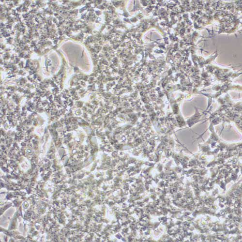 SH-SY5Y 人神經(jīng)母細(xì)胞瘤細(xì)胞