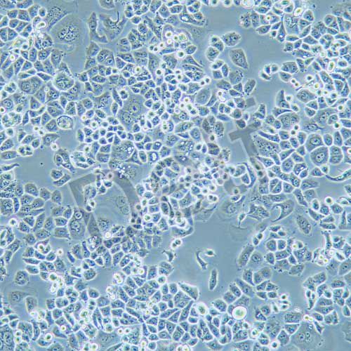SK-BR-3 人乳腺腺癌細胞