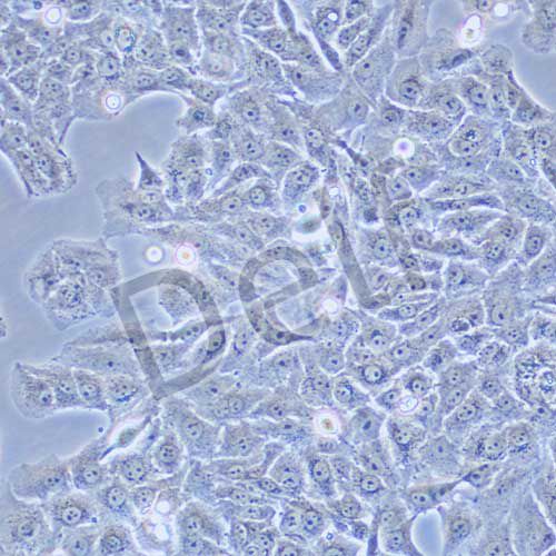 SK-MEL-2 人皮膚黑色素瘤細(xì)胞