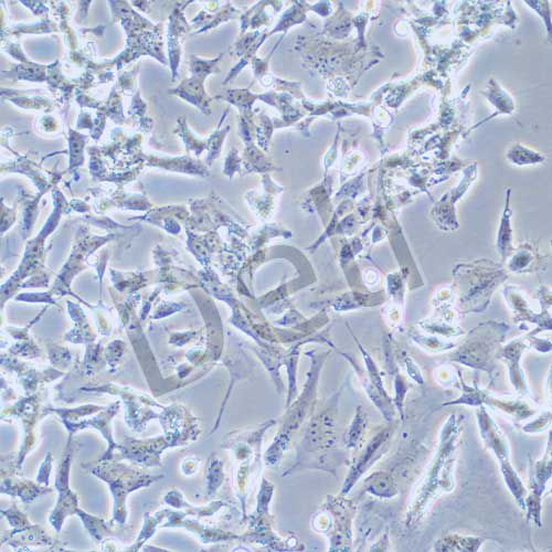 SK-N-BE(2) 人神經(jīng)母細(xì)胞瘤細(xì)胞
