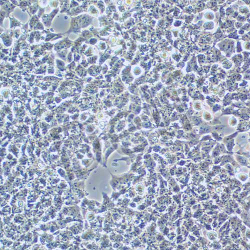 SK-N-MC 人神經(jīng)上皮瘤細(xì)胞