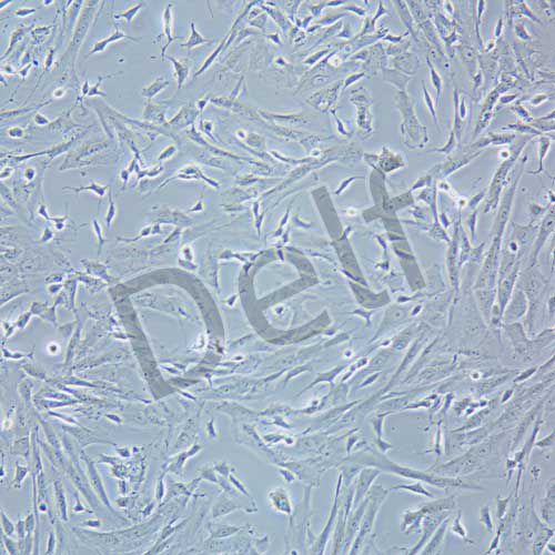 SK-N-SH 人神經(jīng)母細(xì)胞瘤細(xì)胞