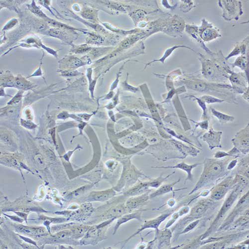 SK-N-SH 人神經(jīng)母細(xì)胞瘤細(xì)胞