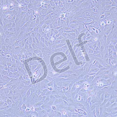 SK-OV-3 人卵巢癌細(xì)胞