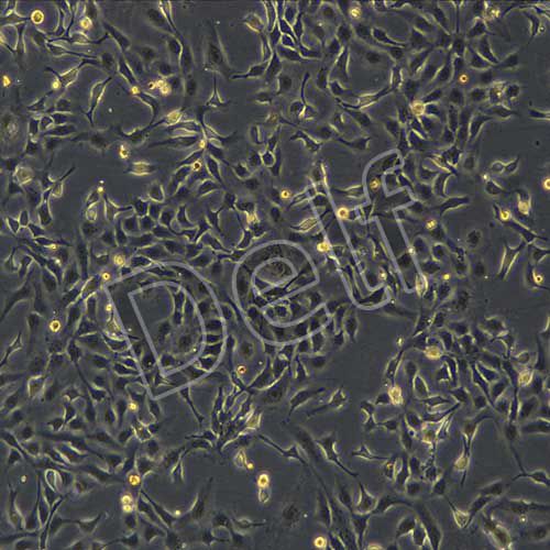 NCI-H2009人肺腺癌細(xì)胞