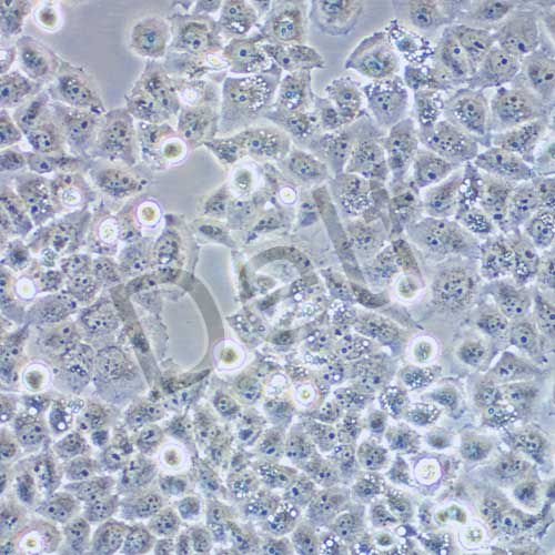 SMMC-7721 人肝癌細(xì)胞