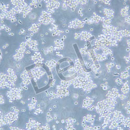 SNU-1 人胃癌細胞