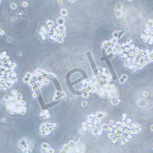 SNU-1 人胃癌細胞