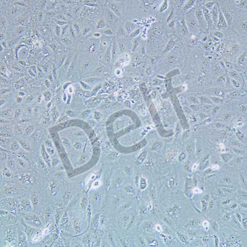 SNU-182 人肝癌細(xì)胞