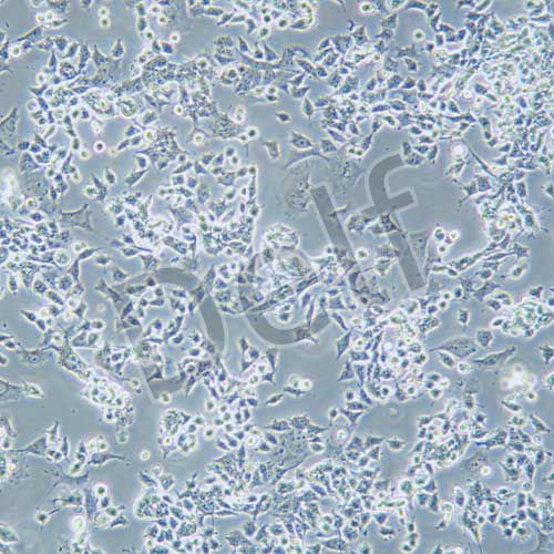 SNU-398 人肝癌細(xì)胞