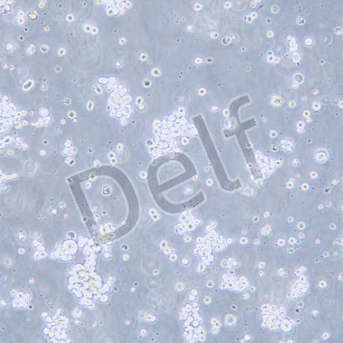 SU-DHL-2 人B細(xì)胞淋巴瘤細(xì)胞